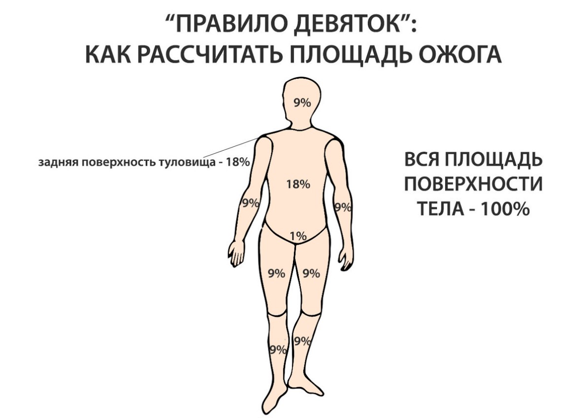 Площадь ожогов