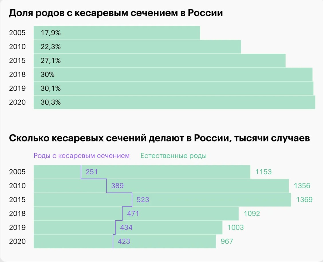 Статистика кесарева сечения