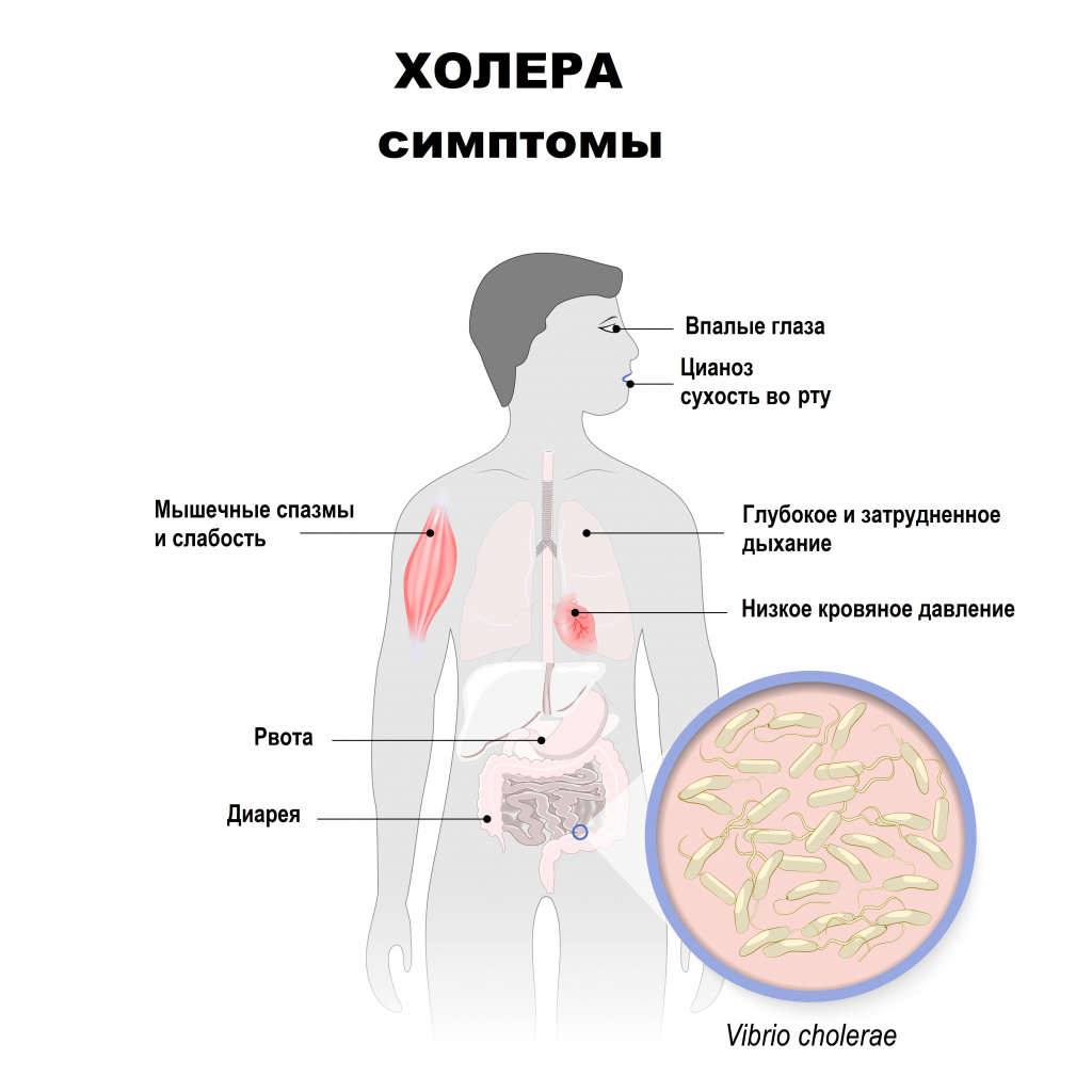 Профилактика холеры картинки