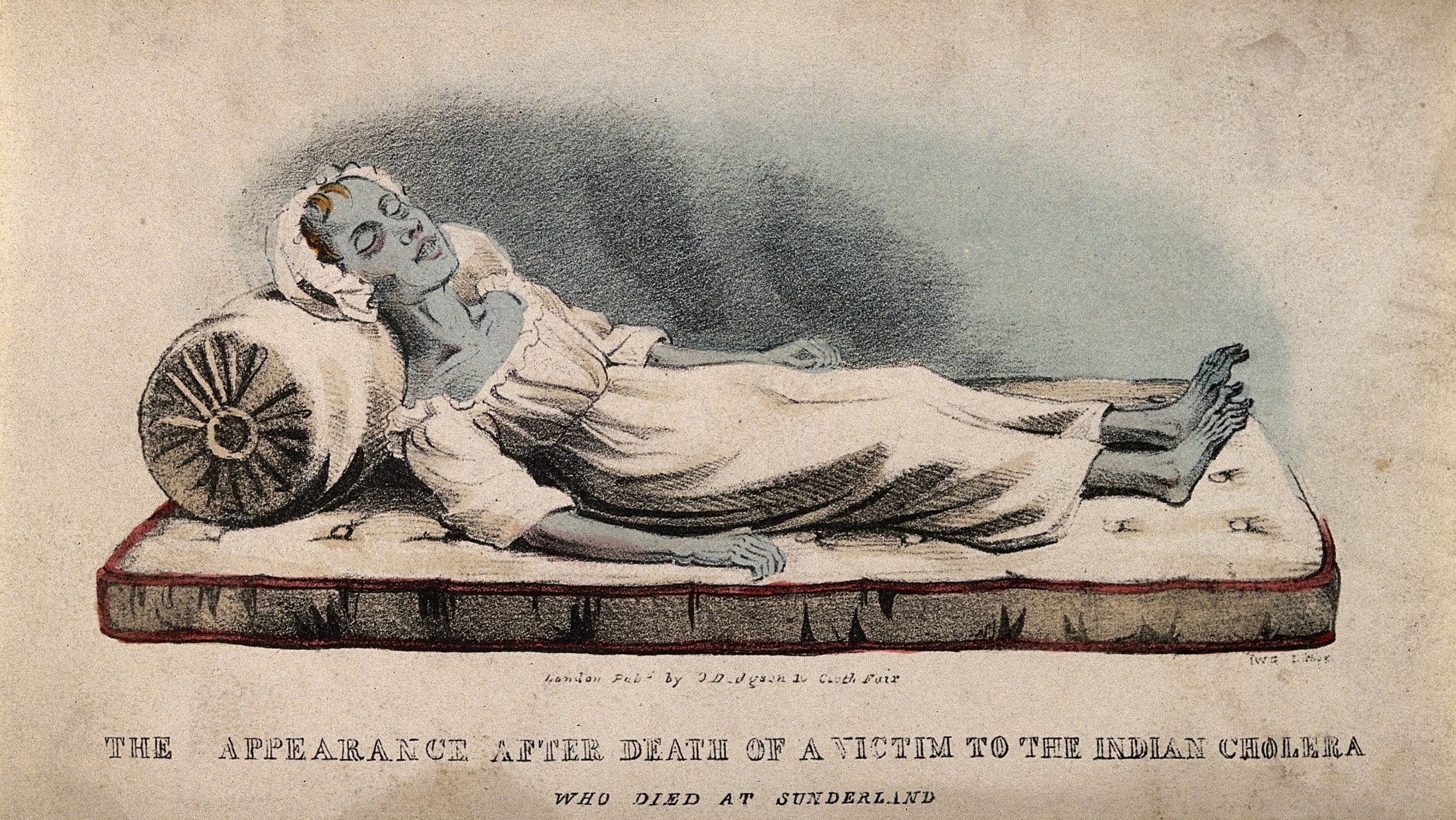 Пандемия холеры в 19 веке